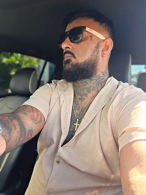 Ricado Brandao protese capilar em Brasilia
